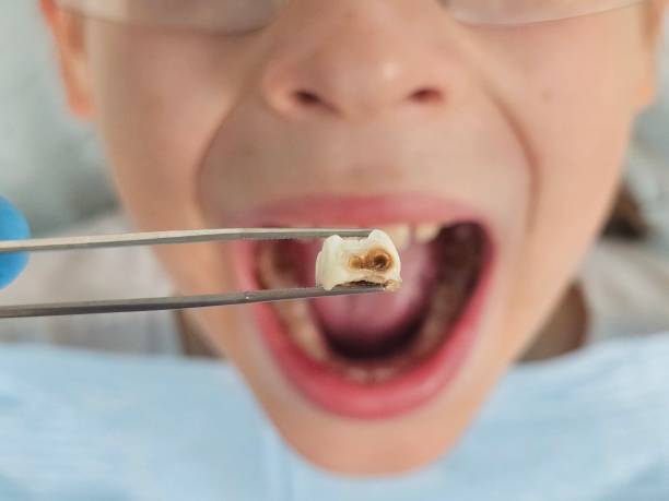 Best Tooth Pain Emergency Relief  in The Colony, TX